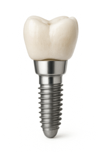 Diş implantı
